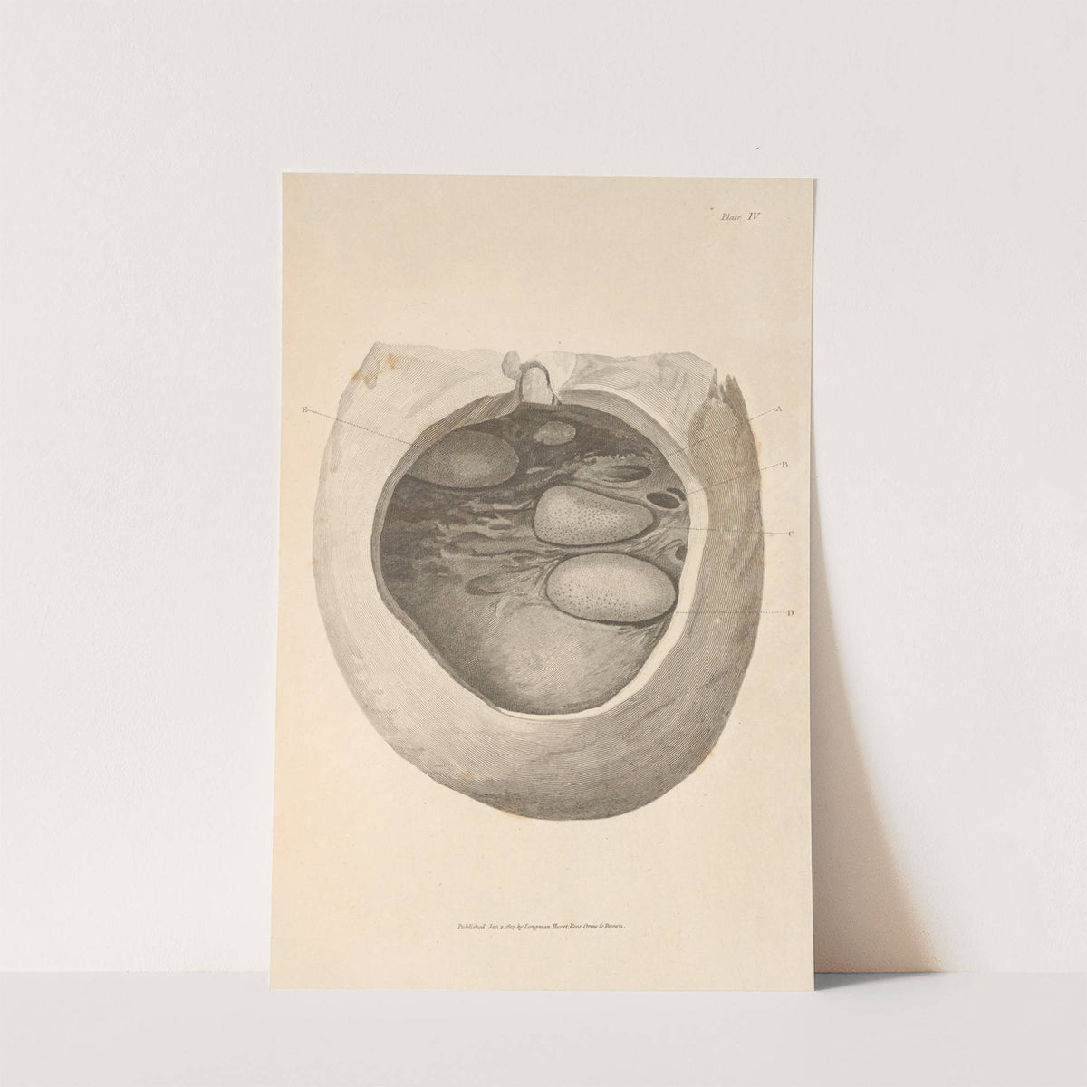 An Essay on the Chemical History and Medical Treatment of Calculous Disorders Pl.1 by Alexander Marcet