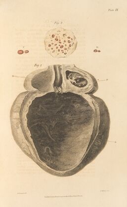 An Essay on the Chemical History and Medical Treatment of Calculous Disorders Pl.6 — size preview
