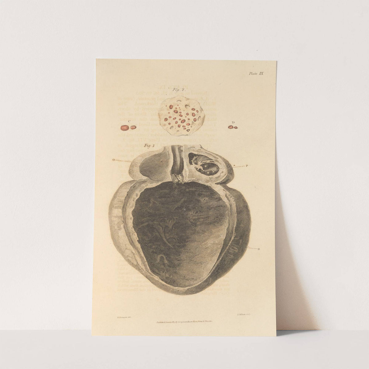 An Essay on the Chemical History and Medical Treatment of Calculous Disorders Pl.6 by Alexander Marcet