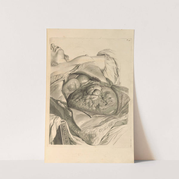 Anatomia humani corporis Pl.056 by Gerard de Lairesse