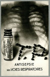 Antisepsie des voies respiratoires (1910-1950)