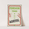 Aortol ; tension tend à sa fin (1910-1950)