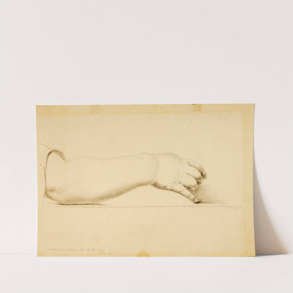 Arm of Child of Hiram Powers by Miner Kilbourne Kellogg