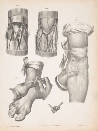 Blood vessels in an arm and a foot, with two sections of an arm or leg showing the anatomy beneath the skin (1840-1843)