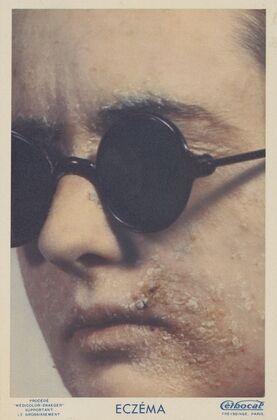 Céthocal (1910-1950)