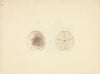 Clypeasteroida (Sand Dollar)