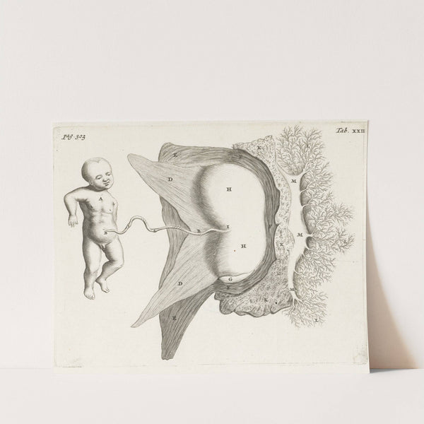 Fetus still connected to the uterus by the umbilical cord (1672) by Hendrik Bary