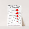 Fibrinolytic therapy in thrombosis; NIH consensus development conference by National Institutes of Health