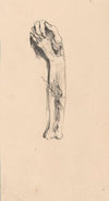 Hand and Arm