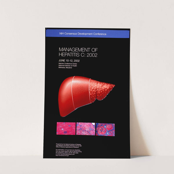 Management of hepatitis C (2002) by National Institutes of Health