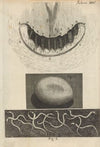 Microscopic view of snail teeth and silkworm egg