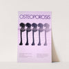 Osteoporosis by National Institutes of Health