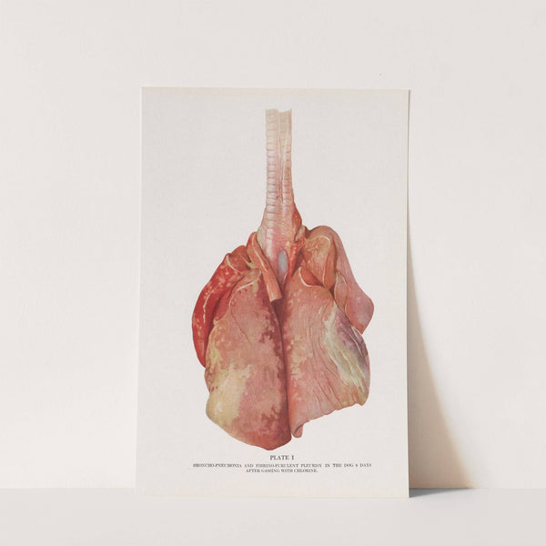 Plate I (Frontispiece): Broncho-pneumonia and fibrino-purulent pleurisy in a dog 8 days after gassing with chlorine. by Milton C. Winternitz