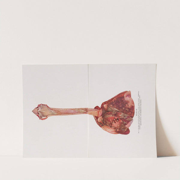 Plate III (Fig. 2): Trachea and lungs of dog dying 5 days after gassing. by Milton C. Winternitz