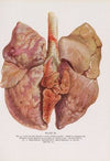 Plate IX (Fig. 16): Lung of dog killed 14 days after gassing.