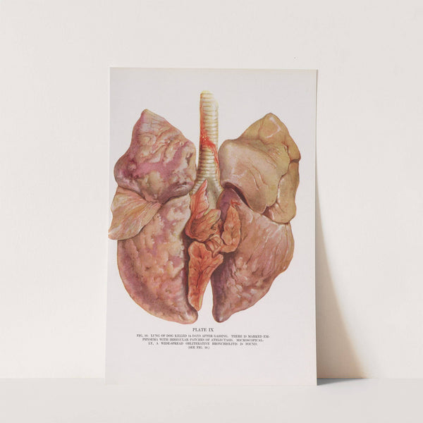 Plate IX (Fig. 16): Lung of dog killed 14 days after gassing. by Milton C. Winternitz