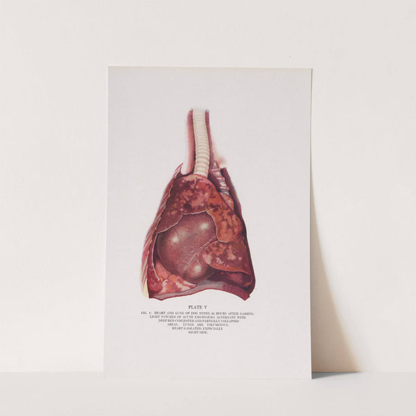 Plate V (Fig. 1): Heart and lung of dog dying 24 hours after gassing. by Milton C. Winternitz