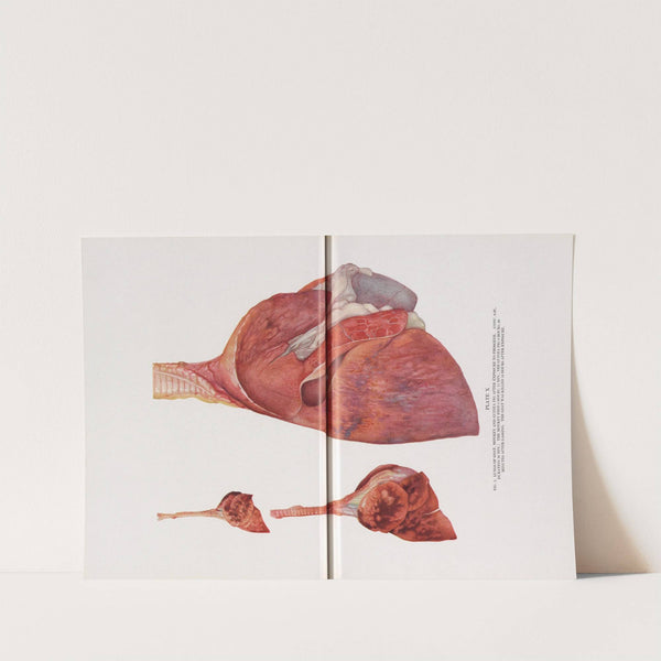 Plate X (Fig. 1): Lungs of goat, monkey, and guinea pig after exposure to phosgene. by Milton C. Winternitz