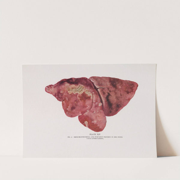 Plate XIV (Fig. 2): Broncho-pneumonia and purulent pleurisy in dog dying 7 days after gassing. by Milton C. Winternitz