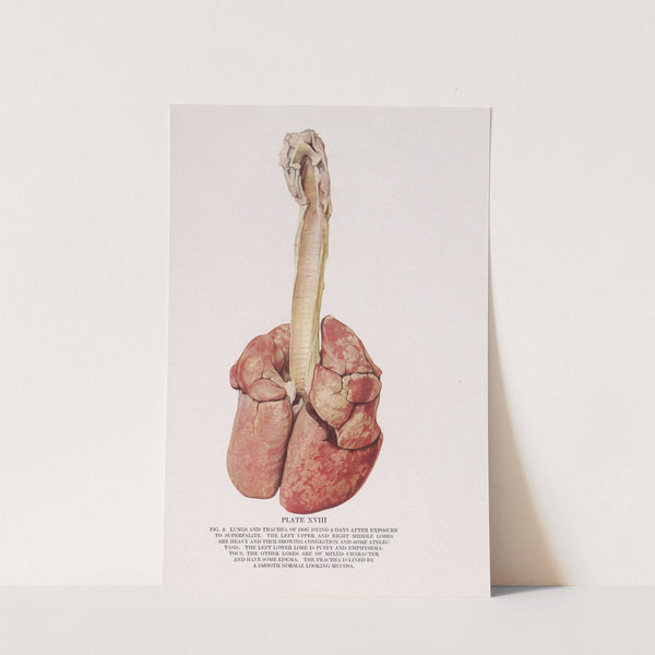 Plate XVIII (Fig. 2): Lungs and trachea of dog dying 2 days after exposure to superpalite. (1920) by Milton C. Winternitz