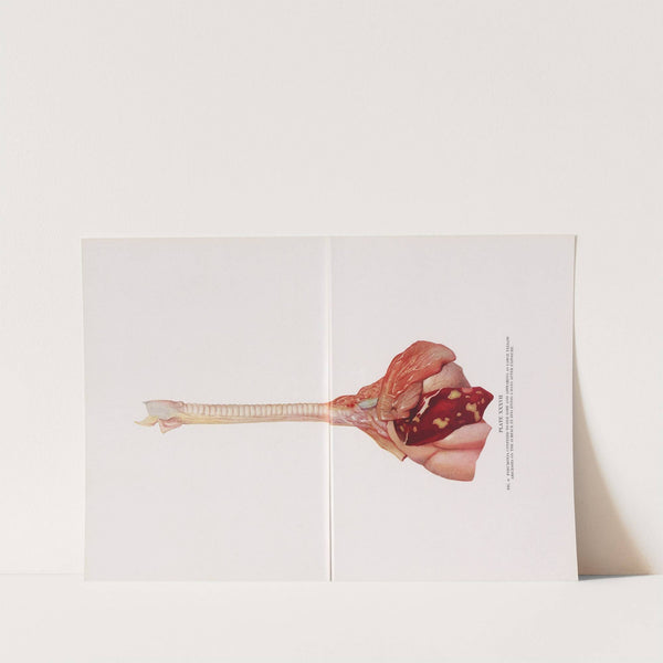 Plate XXXVII (Fig. 6): Pneumonia confined to one lobe and appearing as large yellow abscesses on the surface in dog dying 5 days after exposure. (1920) by Milton C. Winternitz