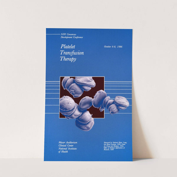 Platelet transfusion therapy by National Institutes of Health