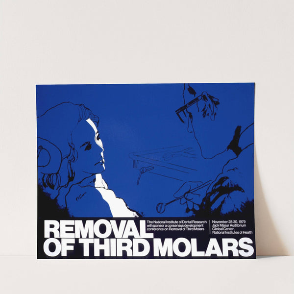 Removal of third molars by National Institutes of Health