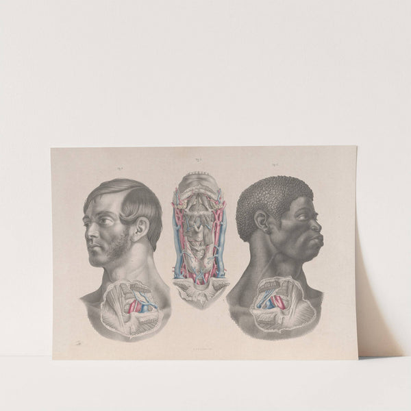 Surgical anatomy Pl.04 (1856) by Joseph Maclise