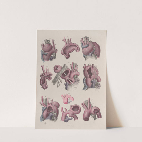 Surgical anatomy Pl.15 (1856) by Joseph Maclise