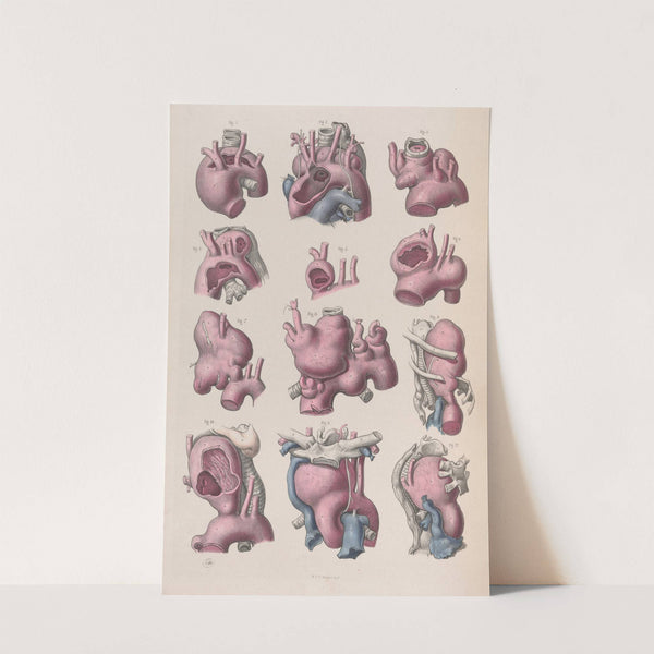 Surgical anatomy Pl.16 (1856) by Joseph Maclise