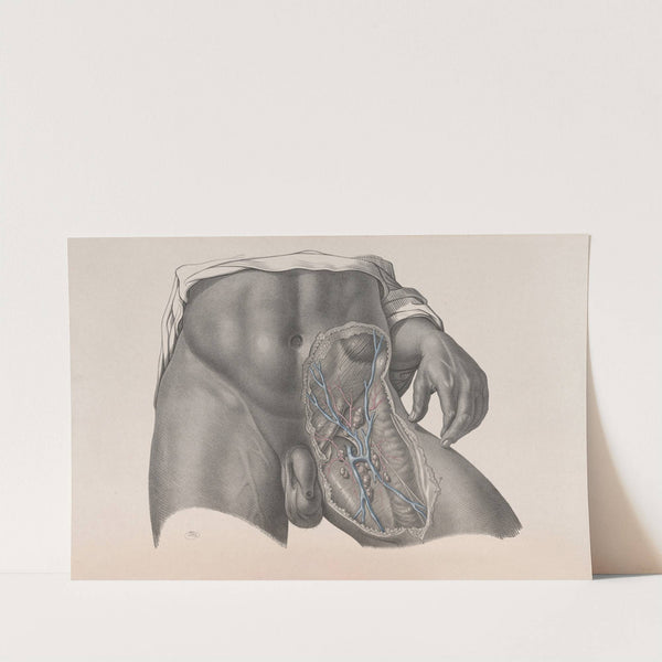 Surgical anatomy Pl.26 (1856) by Joseph Maclise