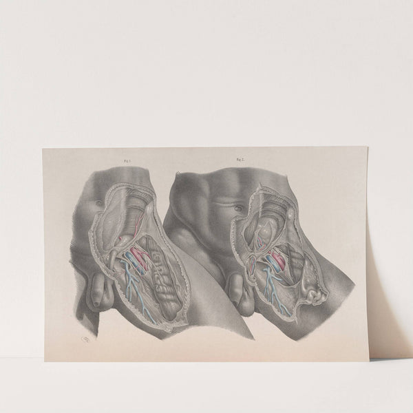 Surgical anatomy Pl.28 (1856) by Joseph Maclise