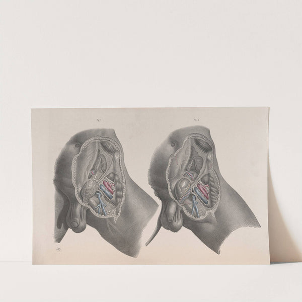 Surgical anatomy Pl.29 (1856) by Joseph Maclise