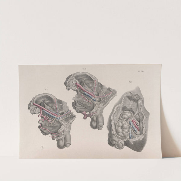 Surgical anatomy Pl.31 (1856) by Joseph Maclise