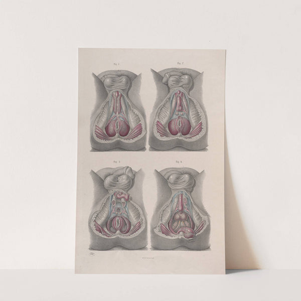 Surgical anatomy Pl.43 (1856) by Joseph Maclise