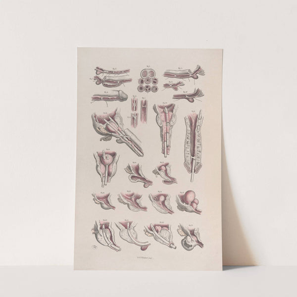 Surgical anatomy Pl.45 (1856) by Joseph Maclise