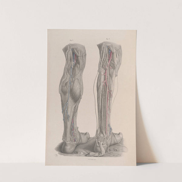 Surgical anatomy Pl.49 (1856) by Joseph Maclise