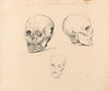 Three Studies of the Skull of Jacobean Antonio Timmerman from Dunkirk