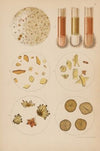 Uric Acid Crystals