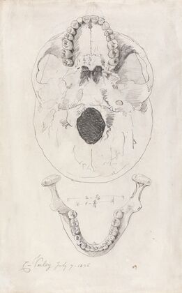 A measured drawing of a skull (1826)