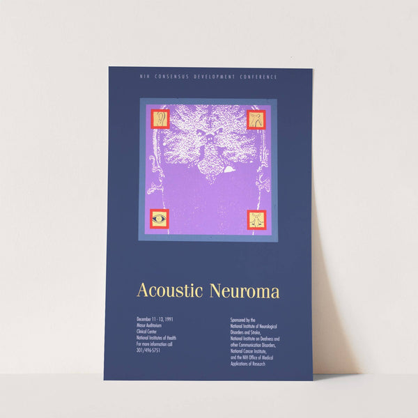 Acoustic neuroma by National Institutes of Health