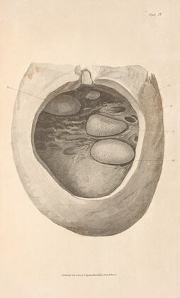 An Essay on the Chemical History and Medical Treatment of Calculous Disorders Pl.1
