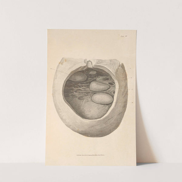 An Essay on the Chemical History and Medical Treatment of Calculous Disorders Pl.1 by Alexander Marcet