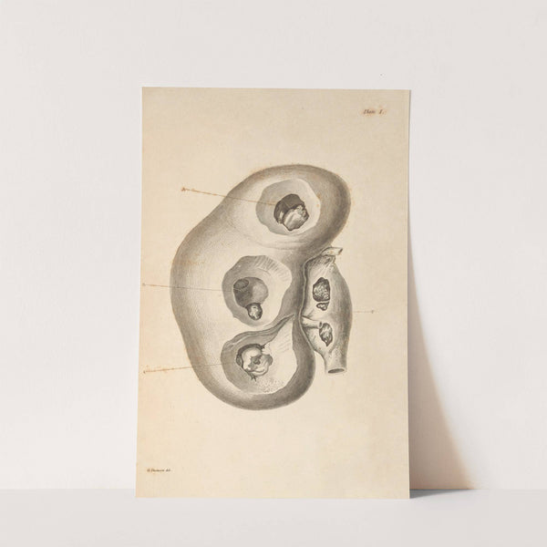 An Essay on the Chemical History and Medical Treatment of Calculous Disorders Pl.7 by Alexander Marcet