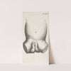 Anatomical illustration of a child&#8217;s penis (1672) by Hendrik Bary