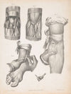 Blood vessels in an arm and a foot, with two sections of an arm or leg showing the anatomy beneath the skin (1840-1843)