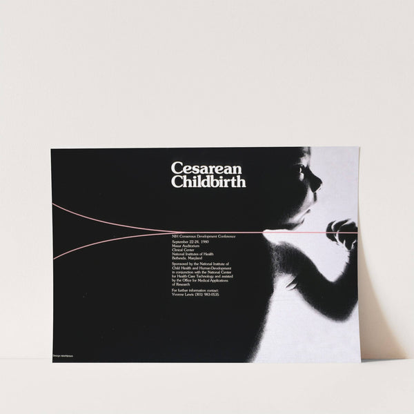 Cesarean childbirth by National Institutes of Health