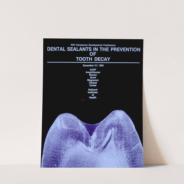 Dental sealants in the prevention of tooth decay by National Institutes of Health