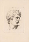 Douleur aigue (1727)