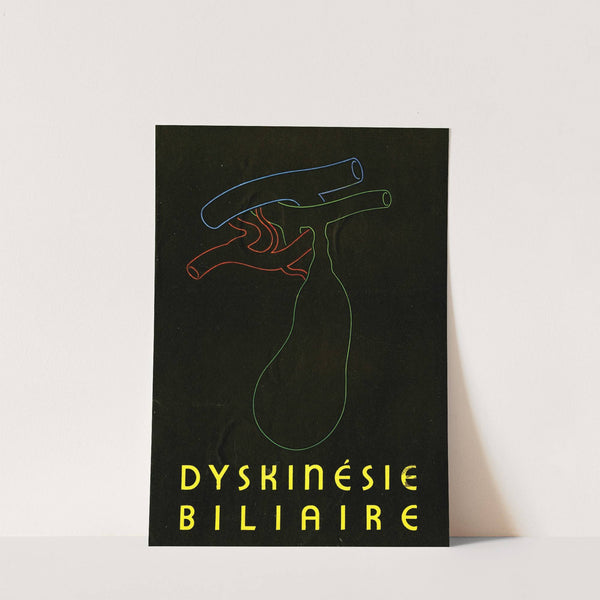 Dyskinésie biliaire (1910-1950)